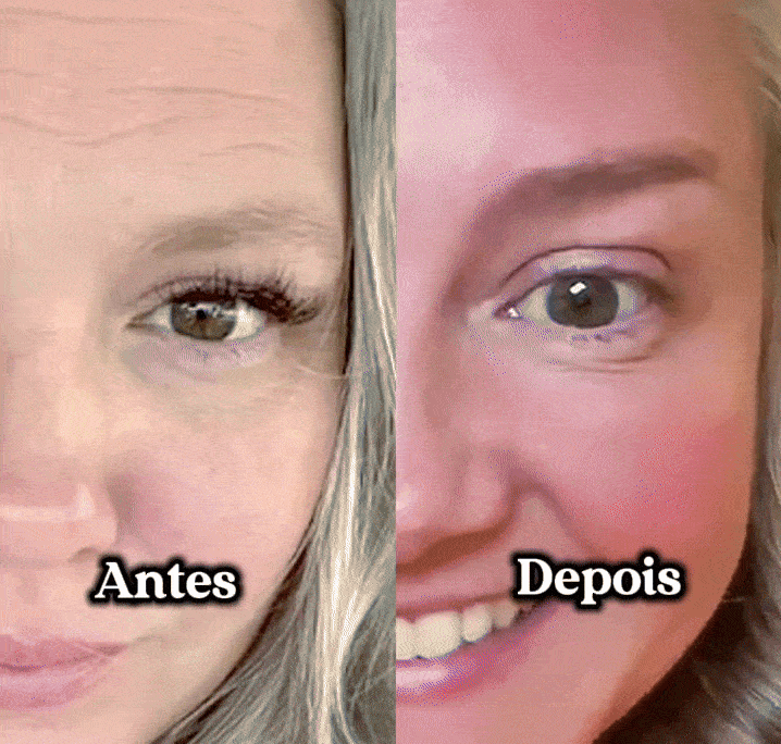 Descrição da imagem