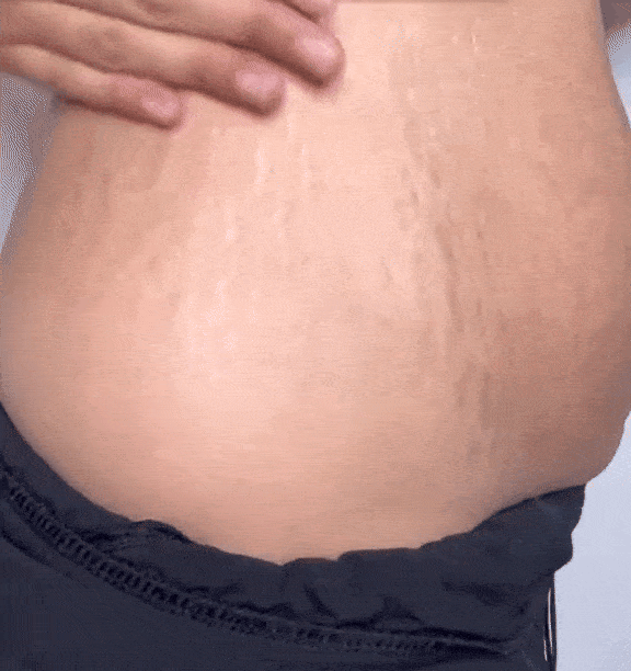 Descrição da imagem